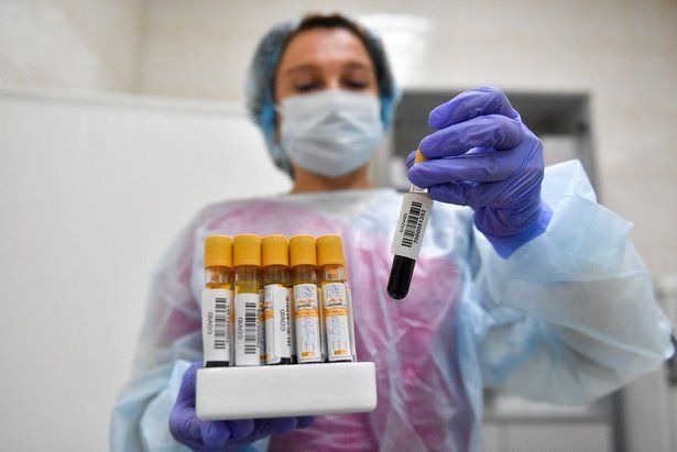 Тестирование на антитела к коронавирусу продлиться в Москве до середины июля