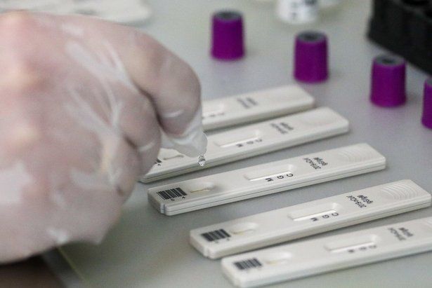 Москва стала лидером по тестам на коронавирус на 100 тыс человек