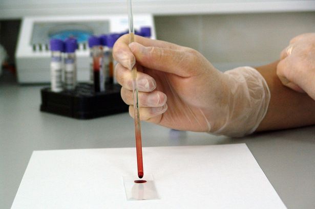 В зеленоградском Роспотребнадзоре работает «горячая линия» по вопросам профилактики ВИЧ-инфекции